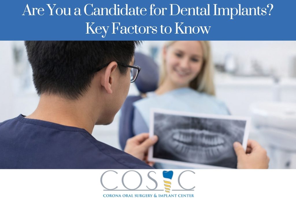 Are You a Candidate for Dental Implants Key Factors to Know