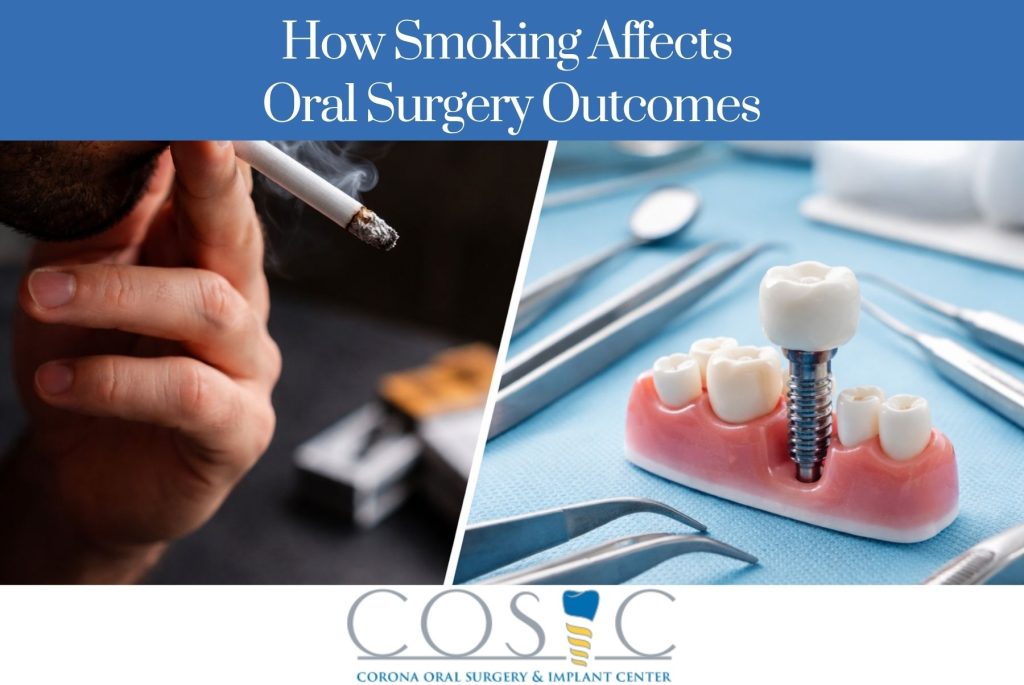 How Smoking Affects Oral Surgery Outcomes