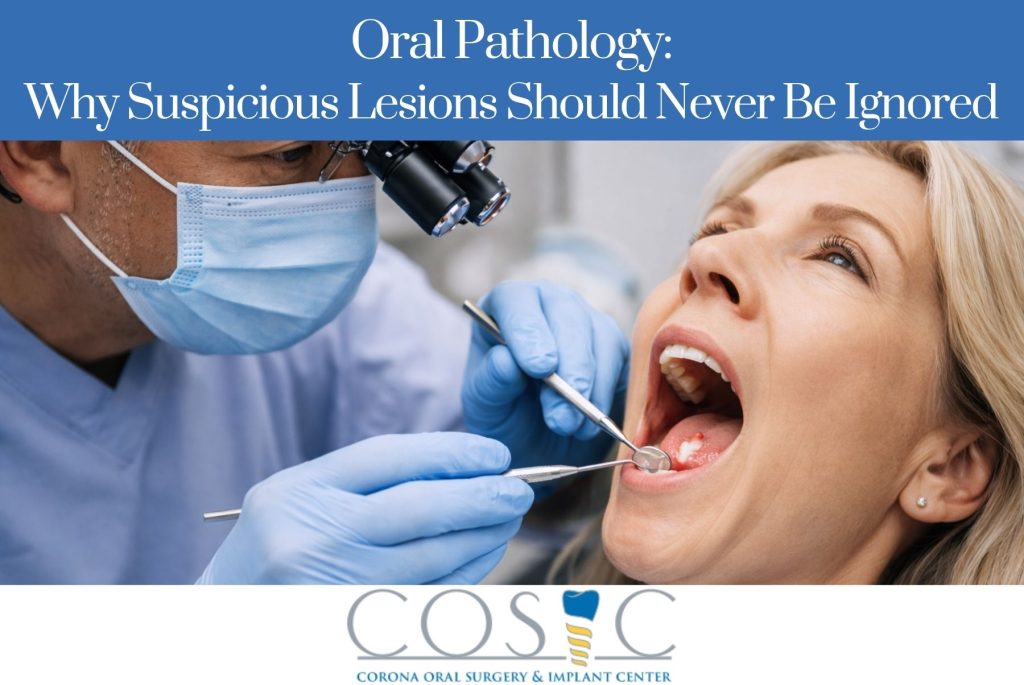 Oral Pathology Why Suspicious Lesions Should Never Be Ignored