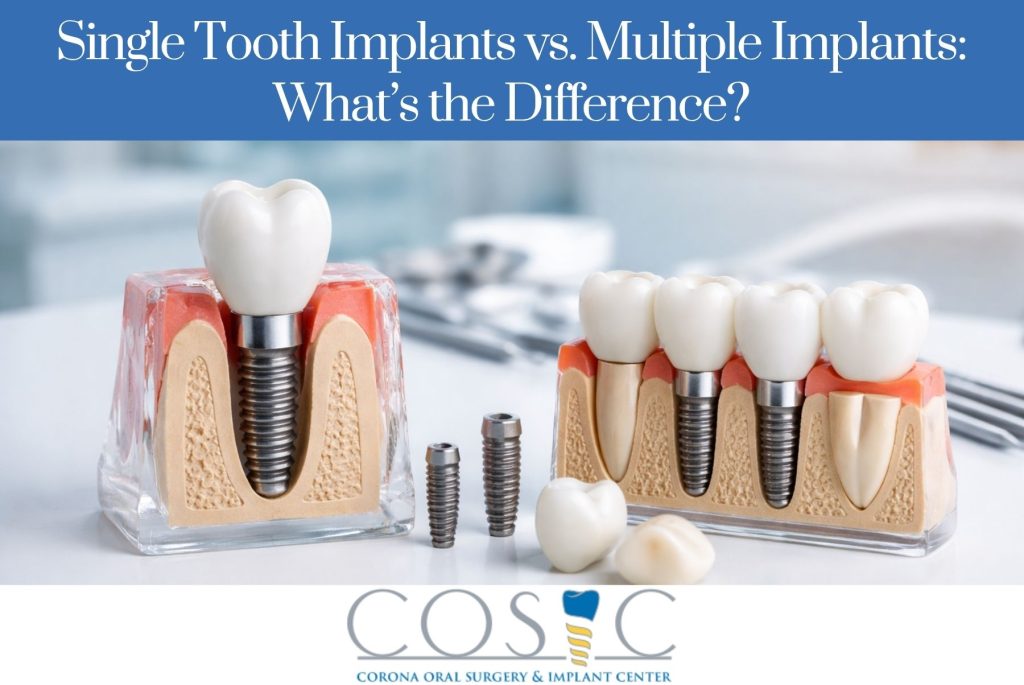 Single Tooth Implants vs. Multiple Implants What’s the Difference