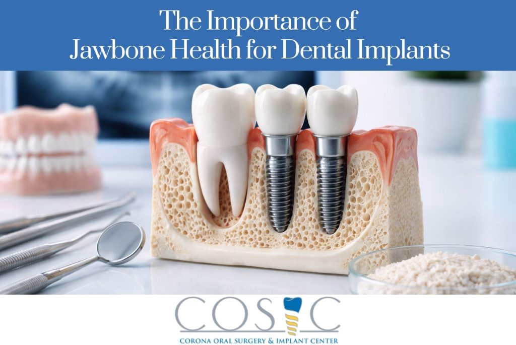 The Importance of Jawbone Health for Dental Implants